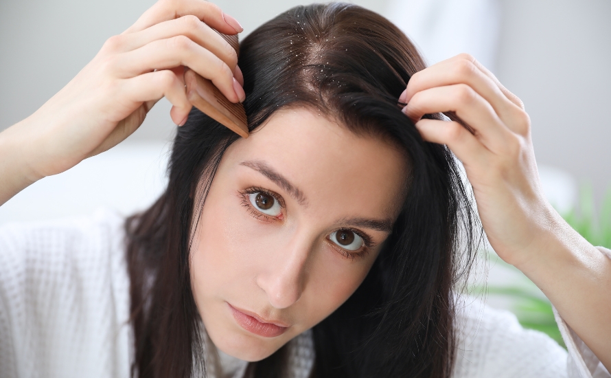 641a3-dandruff-treatments.jpg